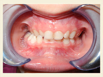 ortodonzia-2