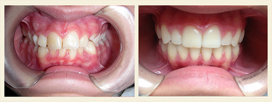 ortodonzia-3